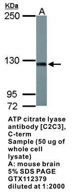 ATP citrate lyase antibody [C2C3], C-term, GeneTex