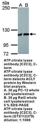 ATP citrate lyase antibody [C2C3], C-term, GeneTex