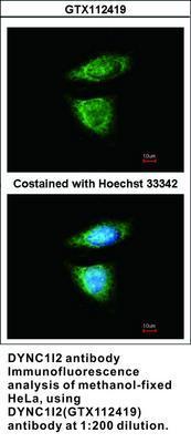 DYNC1I2 antibody, GeneTex