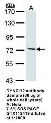 DYNC1I2 antibody, GeneTex