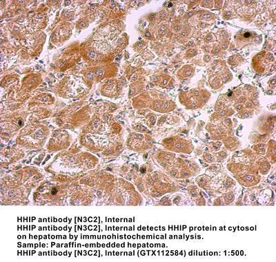 HHIP antibody [N3C2], Internal, GeneTex