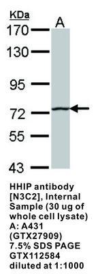 HHIP antibody [N3C2], Internal, GeneTex