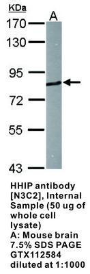 HHIP antibody [N3C2], Internal, GeneTex