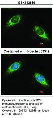 Cytokeratin 19 antibody [N2C3], GeneTex