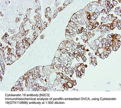 Cytokeratin 19 antibody [N2C3], GeneTex