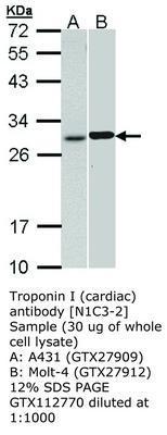 Troponin I (cardiac) antibody [N1C3-2], GeneTex