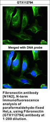 Fibronectin  antibody [N1N2], N-term, GeneTex