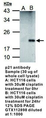 p21 antibody - 100µl, GeneTex