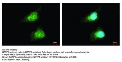 GSTP1 antibody, GeneTex