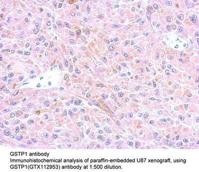 GSTP1 antibody, GeneTex