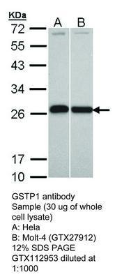 GSTP1 antibody, GeneTex