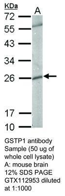 GSTP1 antibody, GeneTex