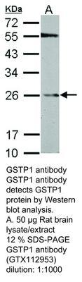 GSTP1 antibody, GeneTex