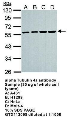 alpha Tubulin 4a antibody, GeneTex