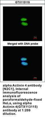 alpha Actinin 4 antibody [N2C1], Internal, GeneTex