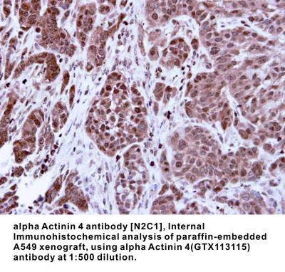 alpha Actinin 4 antibody [N2C1], Internal, GeneTex