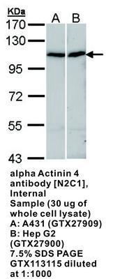 alpha Actinin 4 antibody [N2C1], Internal, GeneTex