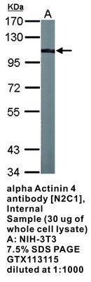 alpha Actinin 4 antibody [N2C1], Internal, GeneTex