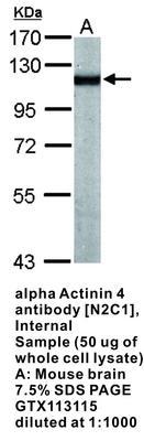 alpha Actinin 4 antibody [N2C1], Internal, GeneTex