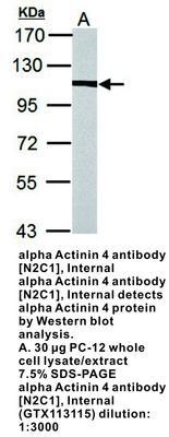 alpha Actinin 4 antibody [N2C1], Internal, GeneTex