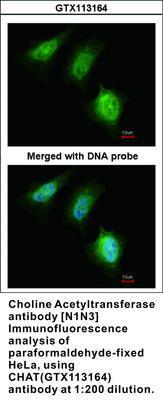 Choline Acetyltransferase antibody [N1N3], GeneTex