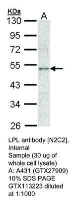 LPL antibody [N2C2], Internal, GeneTex