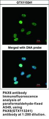 PAX6 antibody [N1C1], GeneTex