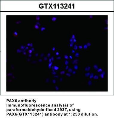 PAX6 antibody [N1C1], GeneTex