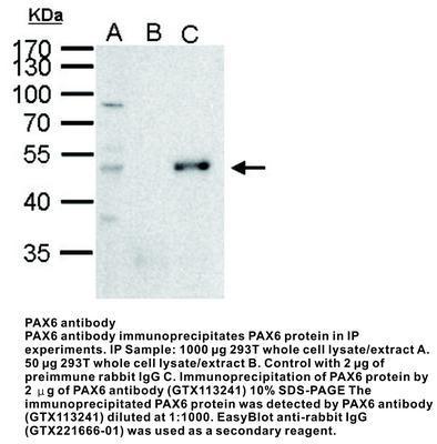 PAX6 antibody [N1C1], GeneTex