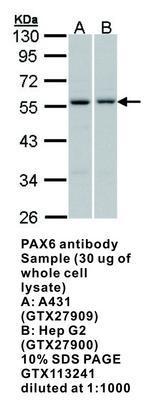 PAX6 antibody [N1C1], GeneTex