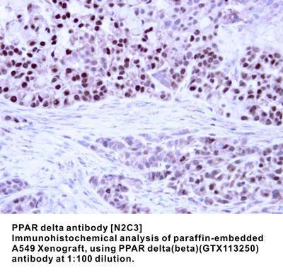 PPAR delta antibody [N2C3], GeneTex