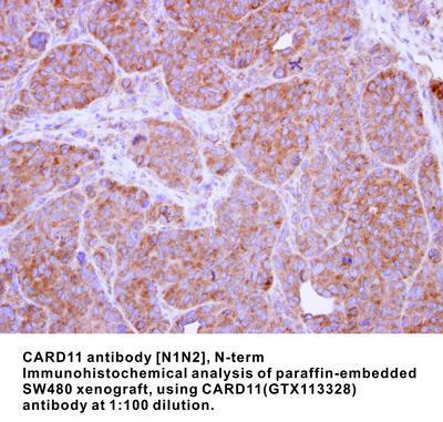 CARD11 antibody [N1N2], N-term, GeneTex