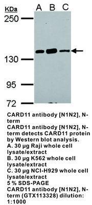 CARD11 antibody [N1N2], N-term, GeneTex