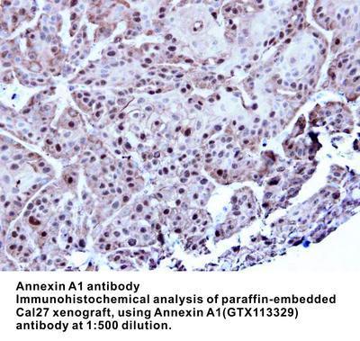 Annexin A1 antibody, GeneTex