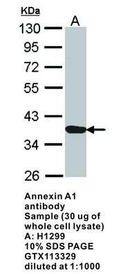 Annexin A1 antibody, GeneTex