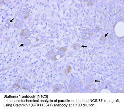 Stathmin 1 antibody [N1C3], GeneTex