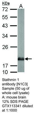 Stathmin 1 antibody [N1C3], GeneTex