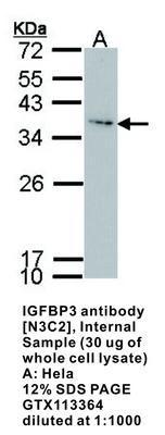 IGFBP3 antibody [N3C2], Internal, GeneTex