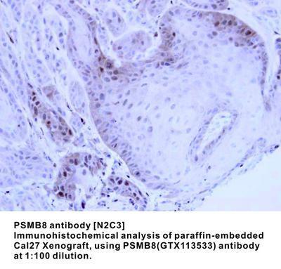 PSMB8 antibody [N2C3], GeneTex