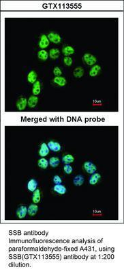 SSB antibody, GeneTex