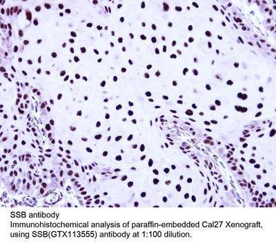 SSB antibody, GeneTex