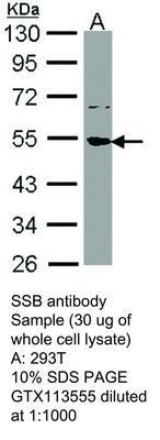 SSB antibody, GeneTex