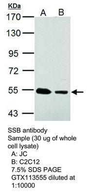 SSB antibody, GeneTex