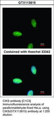 CIKS antibody [C1C3], GeneTex