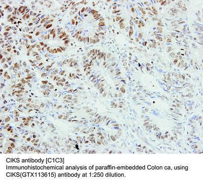 CIKS antibody [C1C3], GeneTex