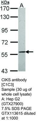 CIKS antibody [C1C3], GeneTex