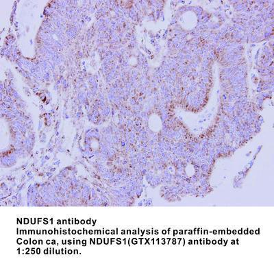 NDUFS1 antibody, GeneTex