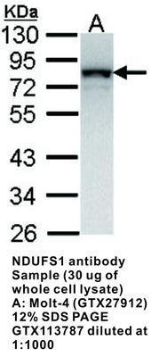 NDUFS1 antibody, GeneTex