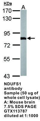 NDUFS1 antibody, GeneTex