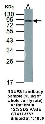 NDUFS1 antibody, GeneTex